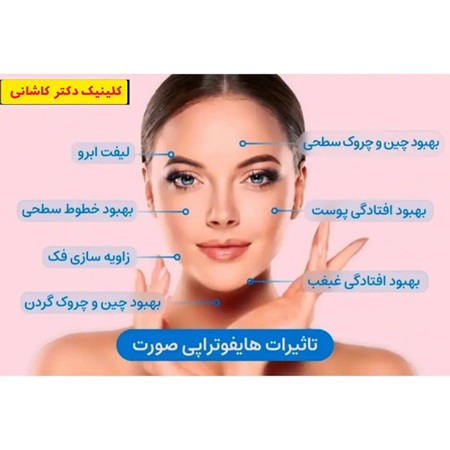 لیفت-صورت-هایفو-مشهد